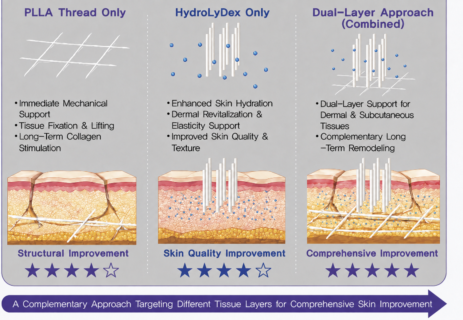 Comparison of PLLA Thread only, HydroLyDex only and the combined Dual-Layer Approach